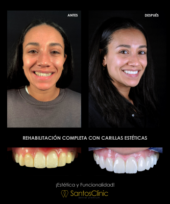 DISE�O DE SONRISAS